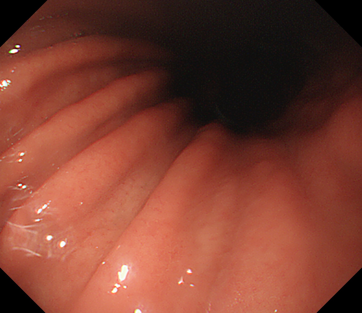 �̉������^(�p�㕔)